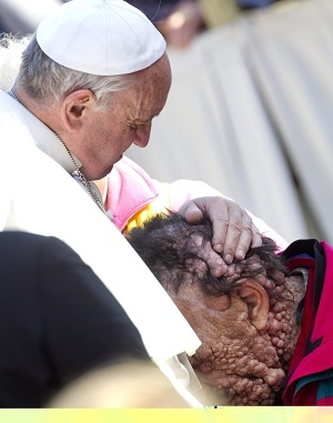 Francis hugs the poor.